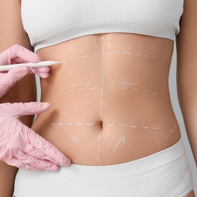 شد البطن مسقط