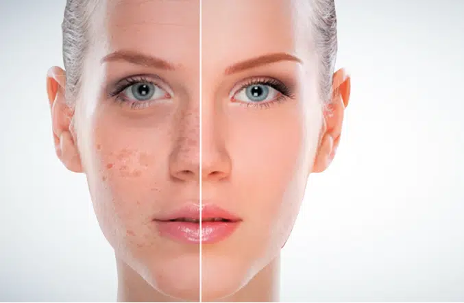 كيف يتغير لون البشرة مع مرور الوقت؟ - Newsglo