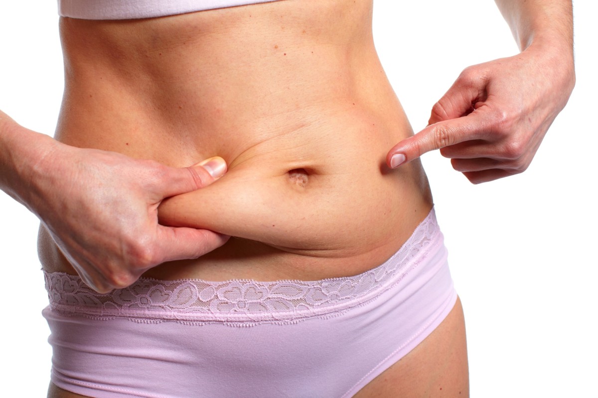 ما الفرق بين عملية شد البطن المصغّرة وعملية شد البطن الكاملة؟ - Newsglo