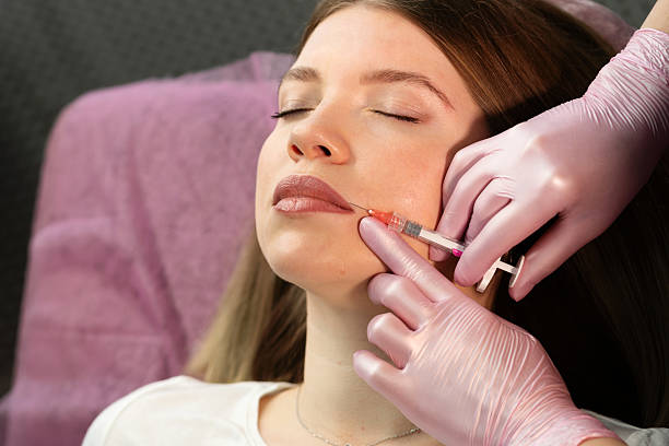 نتائج تدوم طويلاً مع حقن الفيلر للشفتين